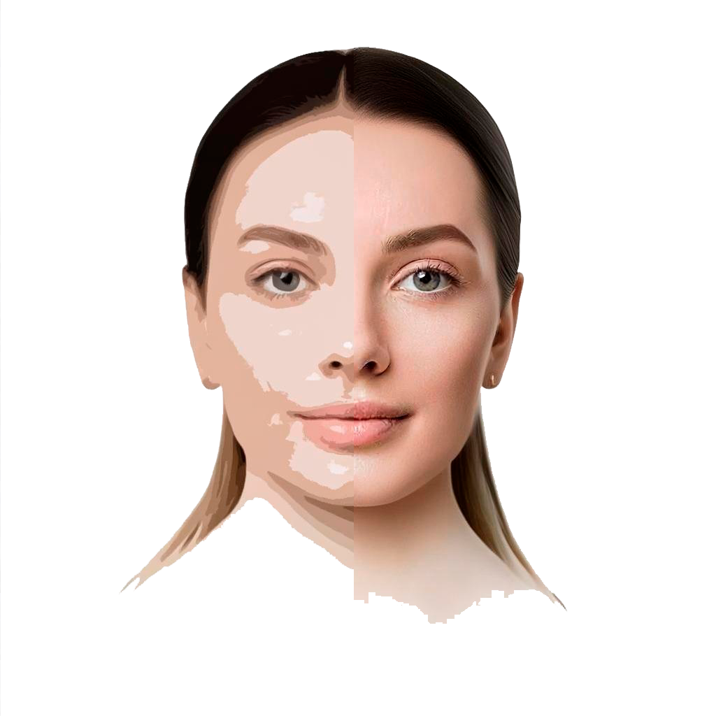 Омоложение